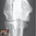Osteoartritis in de voorpoot (elleboog en schouder)