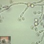 Antibioticumgebruik en afweer